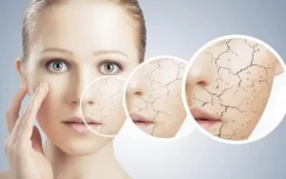 哪些问题说明你皮肤屏障受损？