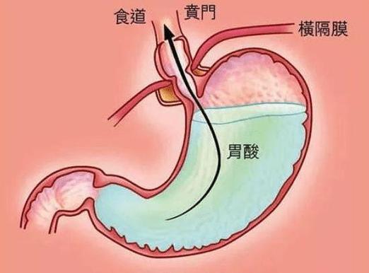 人体8大器官最怕什么？ 第2张